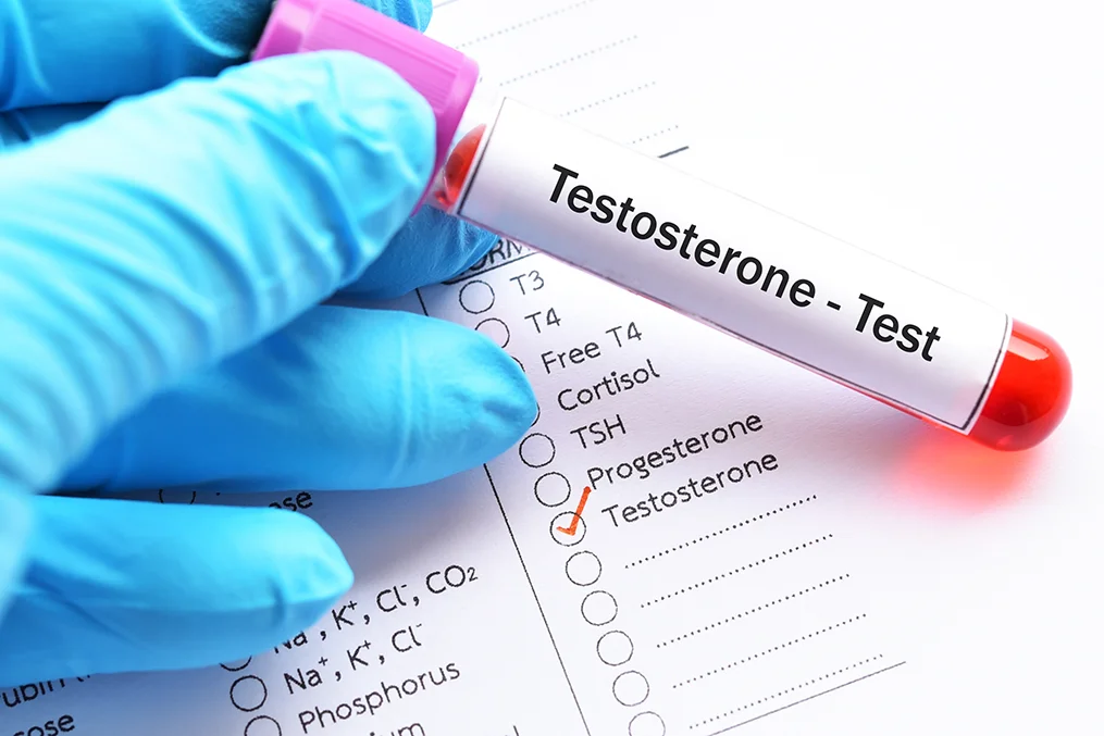 Déficit testosterona